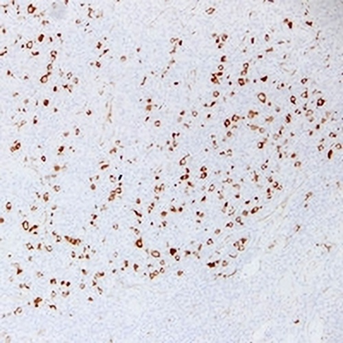 Fascin Mouse Monoclonal Antibody(C2396)