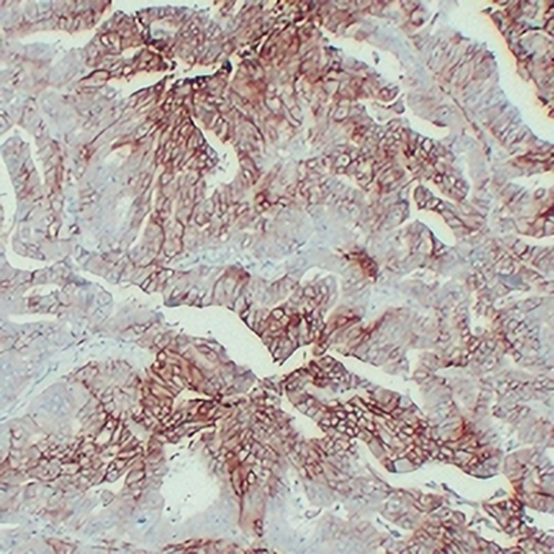 GLUT1 Mouse Monoclonal Antibody(C2398)