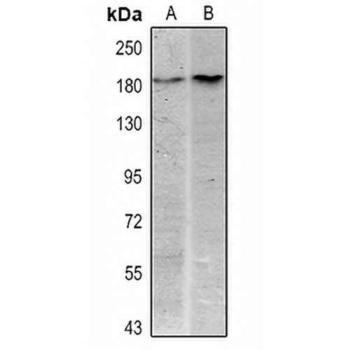 HER2 Mouse Monoclonal Antibody(C2399)