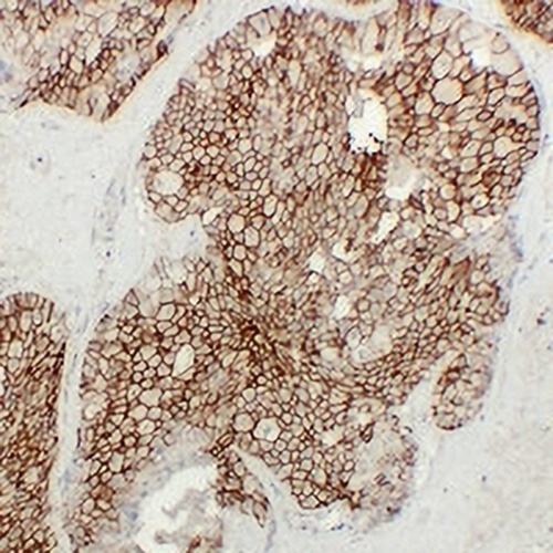 KSP Cadherin Mouse Monoclonal Antibody(C2401)