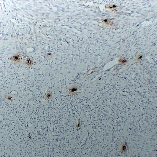 Tryptase alpha/beta Mouse Monoclonal Antibody(C2402)