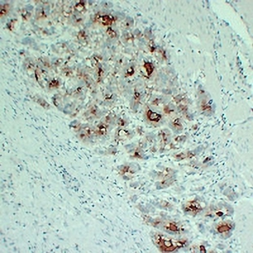 PI3K p110 alpha (H1047R) Mouse Monoclonal Antibody(C2405)