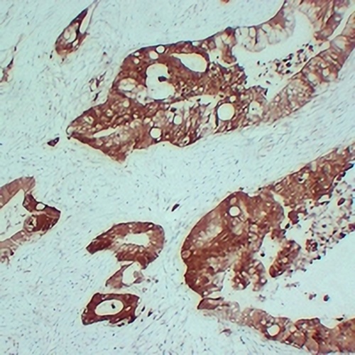 S100-A6 Mouse Monoclonal Antibody(C2406)