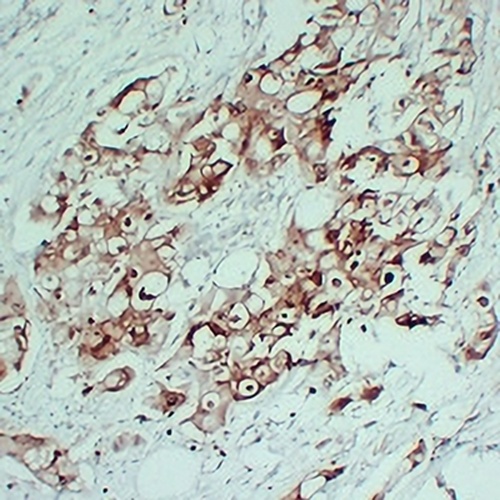 S100-P Mouse Monoclonal Antibody(C2407)