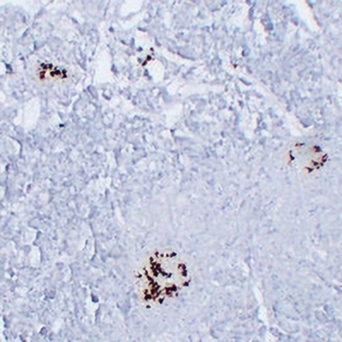 Somatostatin Mouse Monoclonal Antibody(C2408)