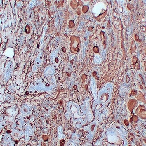 Thyroglobulin Mouse Monoclonal Antibody(C2409)
