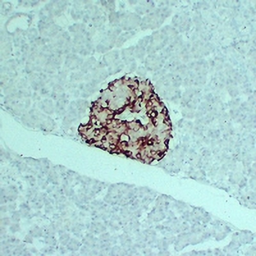 TIMP1 Mouse Monoclonal Antibody(C2410)