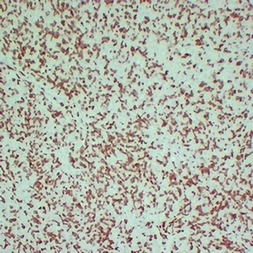 ZAP70 Mouse Monoclonal Antibody(C2411)