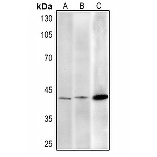 AMACR Mouse Monoclonal Antibody(C2412)