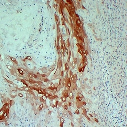 Cytokeratin 10 Mouse Monoclonal Antibody(C2413)