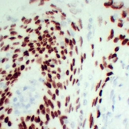 p63 Mouse Monoclonal Antibody(C2417)