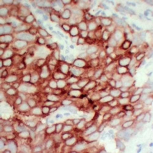 PS2 Mouse Monoclonal Antibody(C2419)