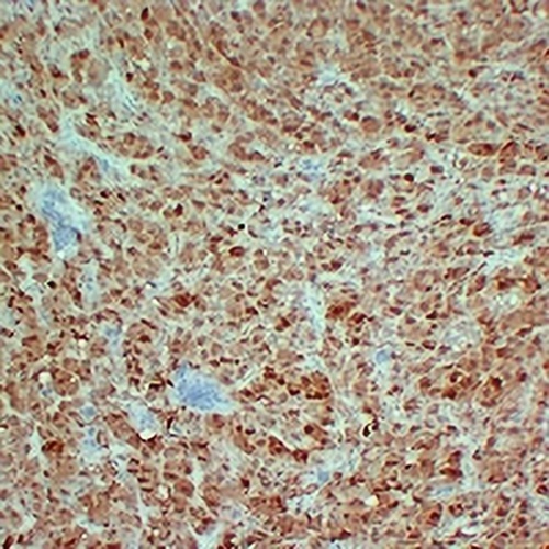 S100-B Mouse Monoclonal Antibody(C2421)