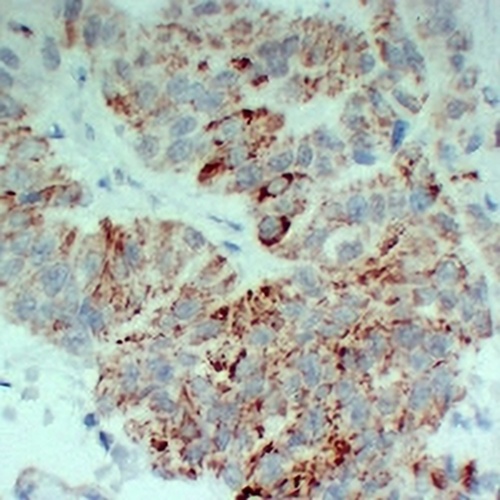 TGFBR2 Mouse Monoclonal Antibody(C2424)