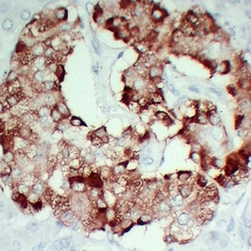 TIMP1 Mouse Monoclonal Antibody(C2425)