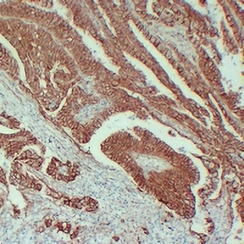 Beta-catenin Mouse Monoclonal Antibody(C2426)