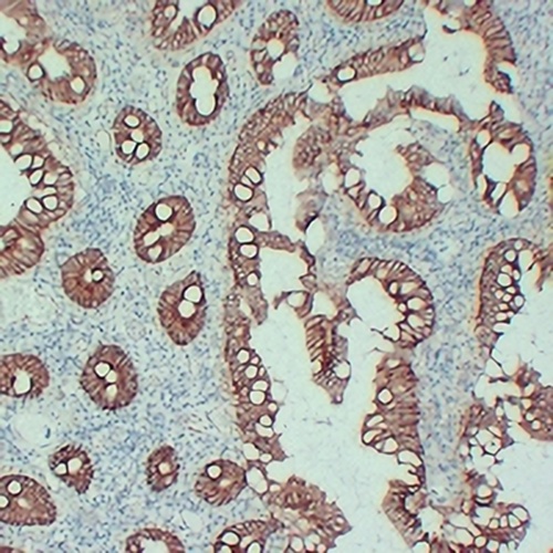 Beta-catenin Mouse Monoclonal Antibody(C2427)