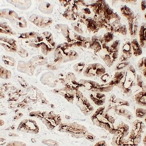 TMPase Mouse Monoclonal Antibody(C2430)