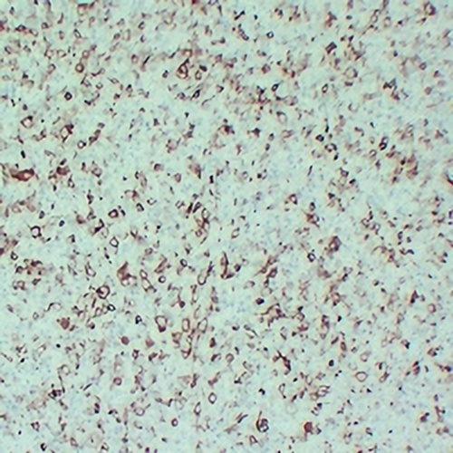 STMN1 Mouse Monoclonal Antibody(C2432)