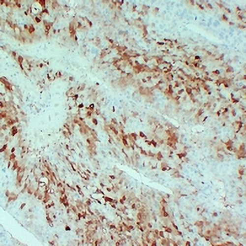 Arginase 1 Mouse Monoclonal Antibody(C2434)