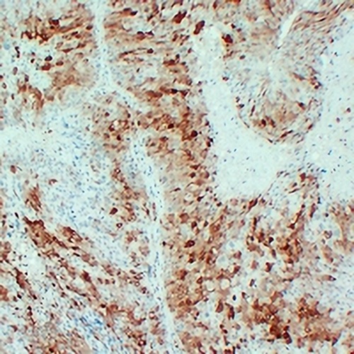 Arginase 1 Mouse Monoclonal Antibody(C2435)