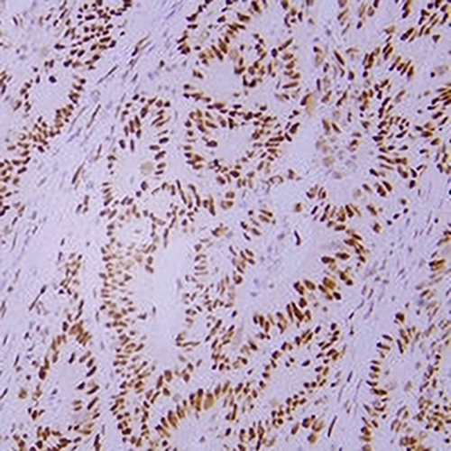MSH2 Mouse Monoclonal Antibody(C2436)