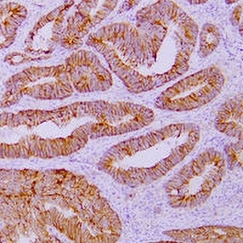 Catenin delta 1 Mouse Monoclonal Antibody(C2437)