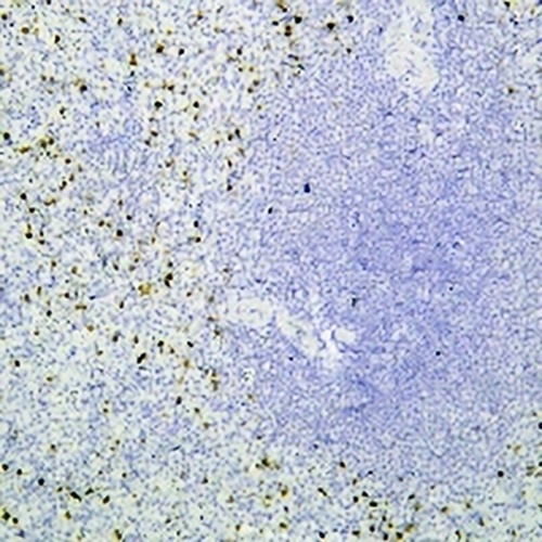 Perforin 1 Mouse Monoclonal Antibody(C2438)