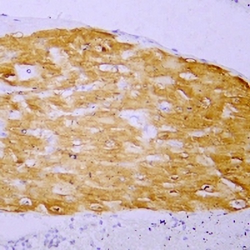 Myoglobin Mouse Monoclonal Antibody(C2439)