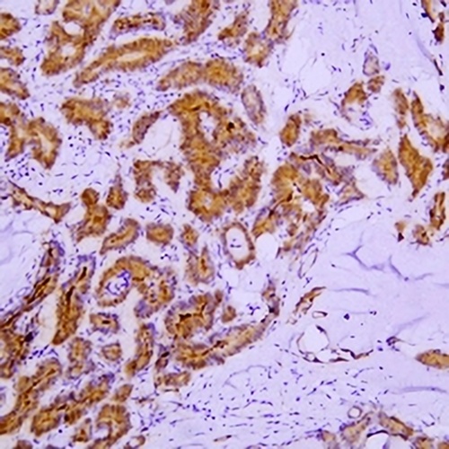 Galectin 3 Mouse Monoclonal Antibody(C2441)