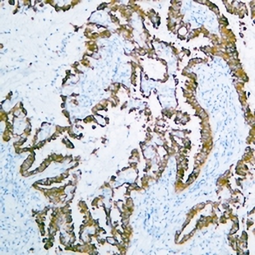 Cytokeratin-pan Mouse Monoclonal Antibody(C2442)