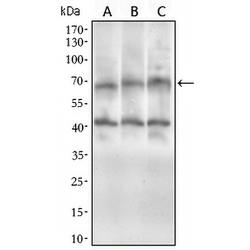 ABCG5 Mouse Monoclonal Antibody(C2482)