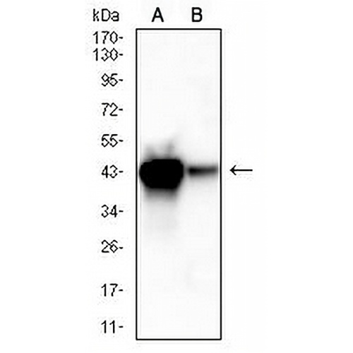 ACAA1 Mouse Monoclonal Antibody(C2484)
