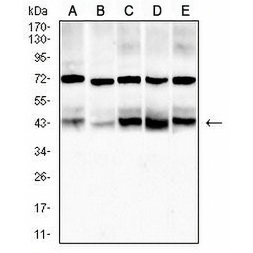 ACADM Mouse Monoclonal Antibody(C2485)