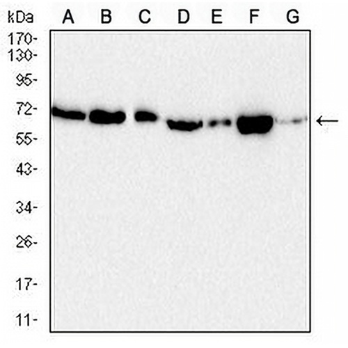 Acetylcholinesterase Mouse Monoclonal Antibody(C2486)