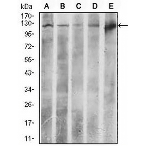 ACLY Mouse Monoclonal Antibody(C2487)