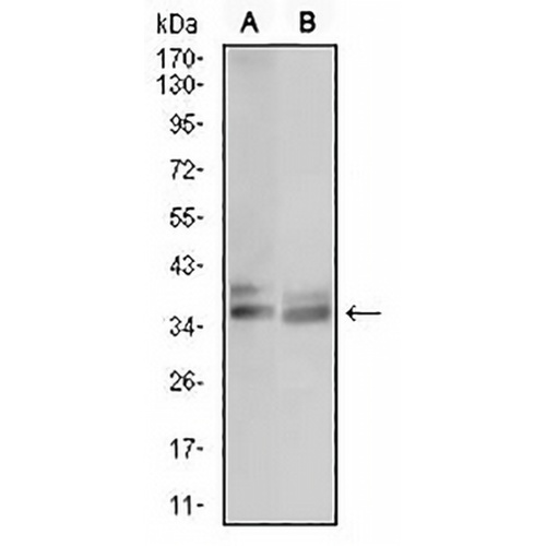 ACP5 Mouse Monoclonal Antibody(C2488)