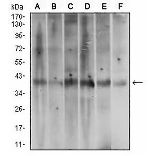 ACP5 Mouse Monoclonal Antibody(C2489)