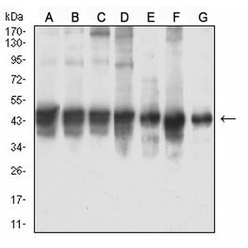 Smooth Muscle Actin Mouse Monoclonal Antibody(C2491)