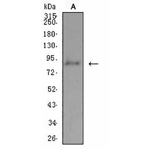 ADAMTS1 Mouse Monoclonal Antibody(C2494)