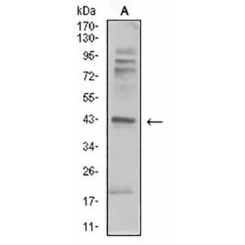 Beta-2 Adrenergic Receptor Mouse Monoclonal Antibody(C2497)