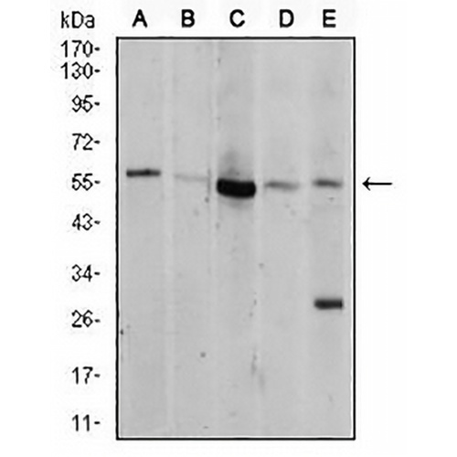 AKT Mouse Monoclonal Antibody(C2501)