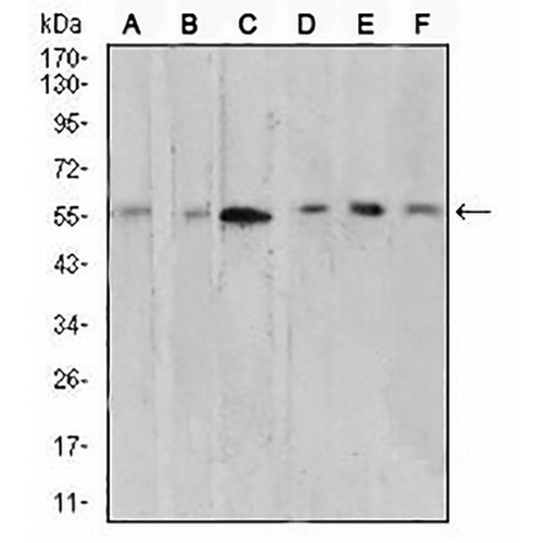 AKT Mouse Monoclonal Antibody(C2502)