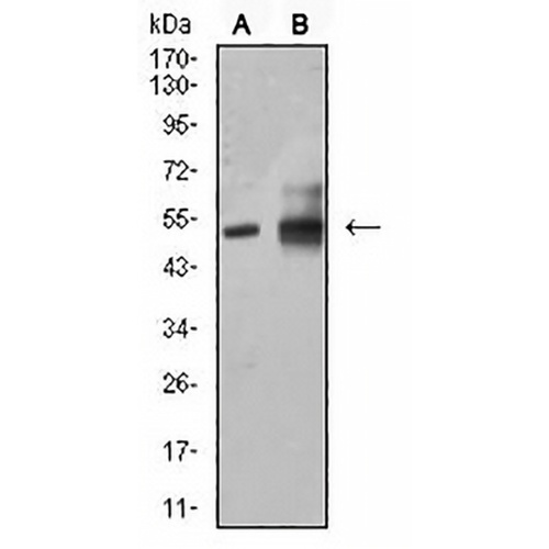 ALDH1A1 Mouse Monoclonal Antibody(C2505)