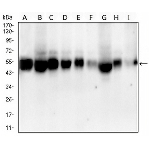 ALDH2 Mouse Monoclonal Antibody(C2507)