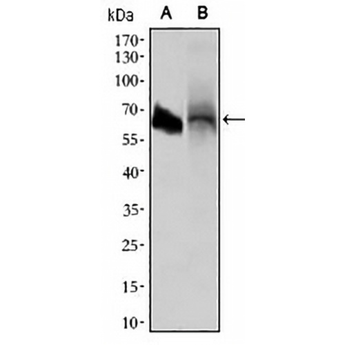 ALPI Mouse Monoclonal Antibody(C2511)