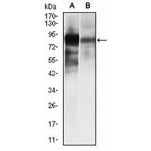 ALPL Mouse Monoclonal Antibody(C2512)