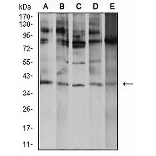 ATF4 Mouse Monoclonal Antibody(C2527)