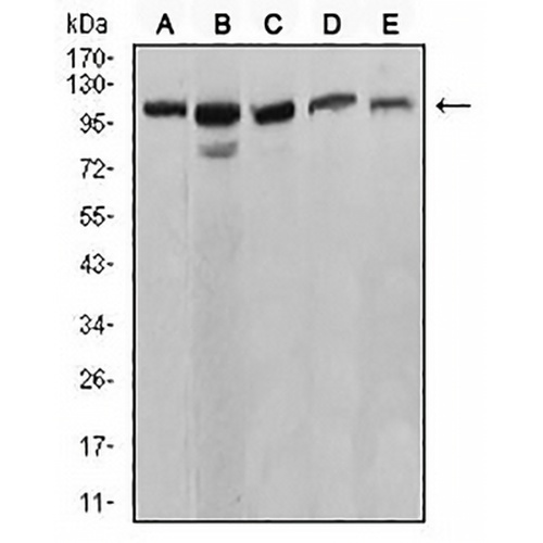 SERCA1 Mouse Monoclonal Antibody(C2535)