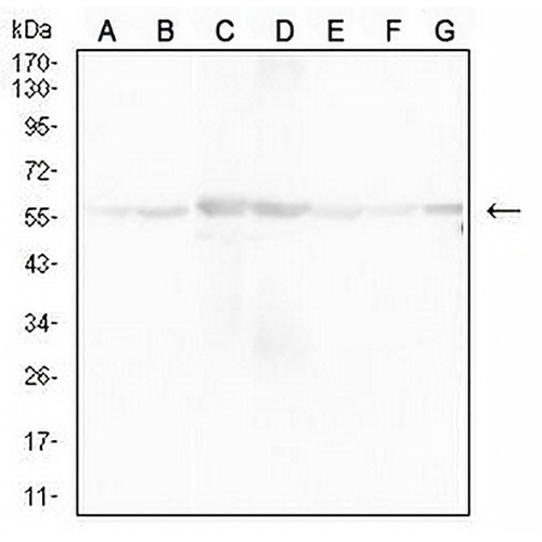 ATP5A1 Mouse Monoclonal Antibody(C2536)
